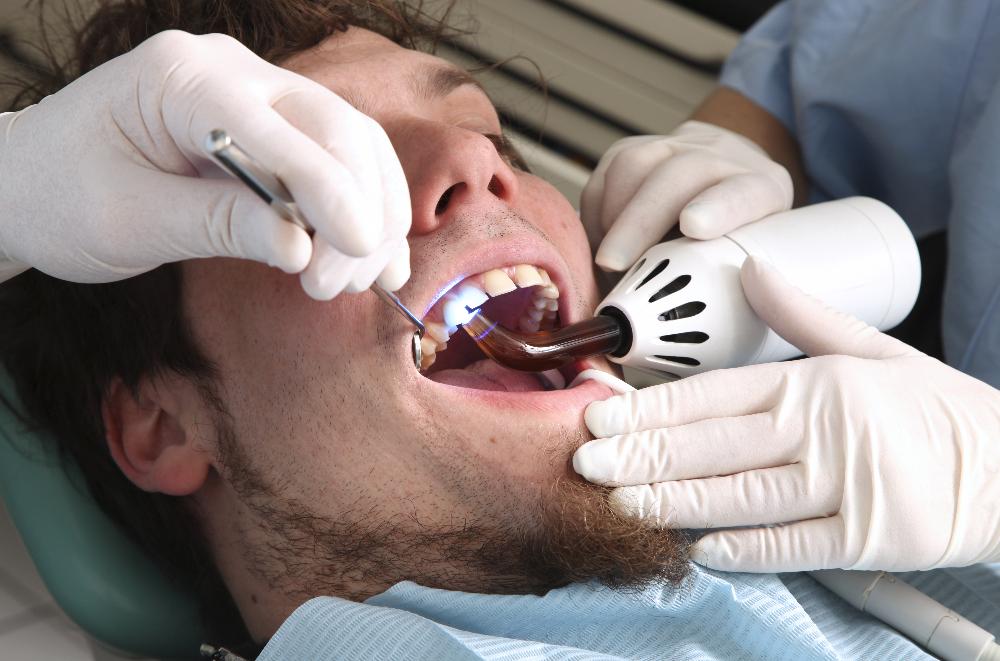man receiving dentist cleaning | dentist sunnyvale ca