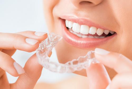 close up of clear plastic aligner | sunnyvale ca dentist