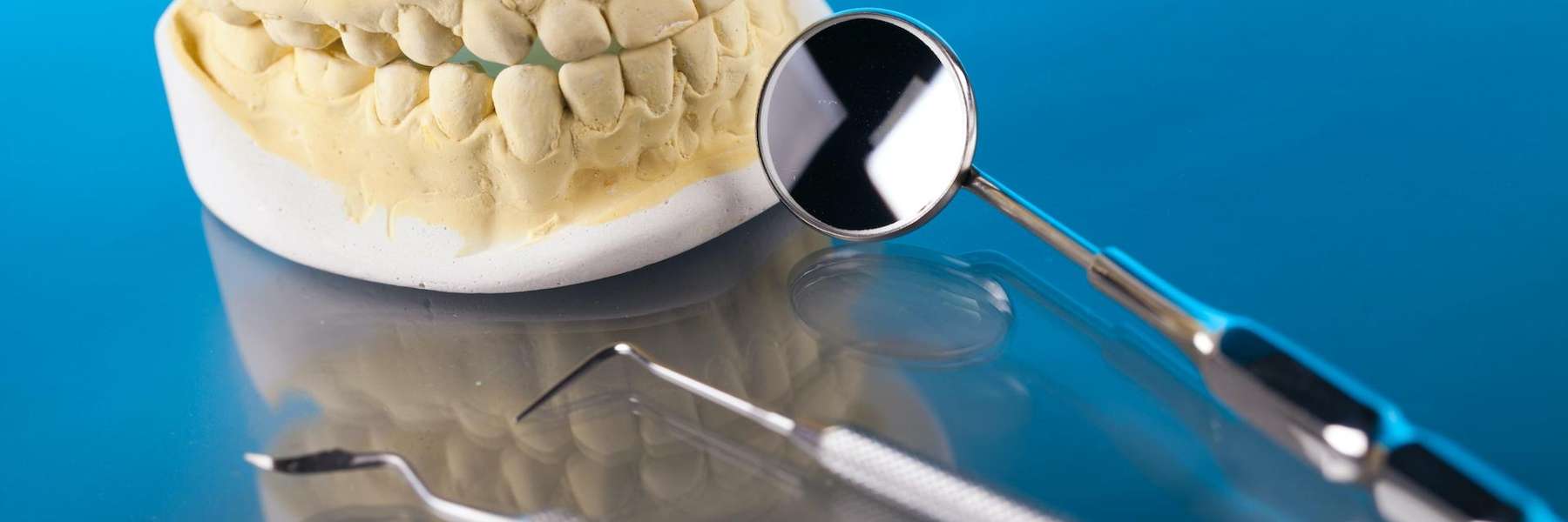 close up of mouth impression | sunnyvale dentist