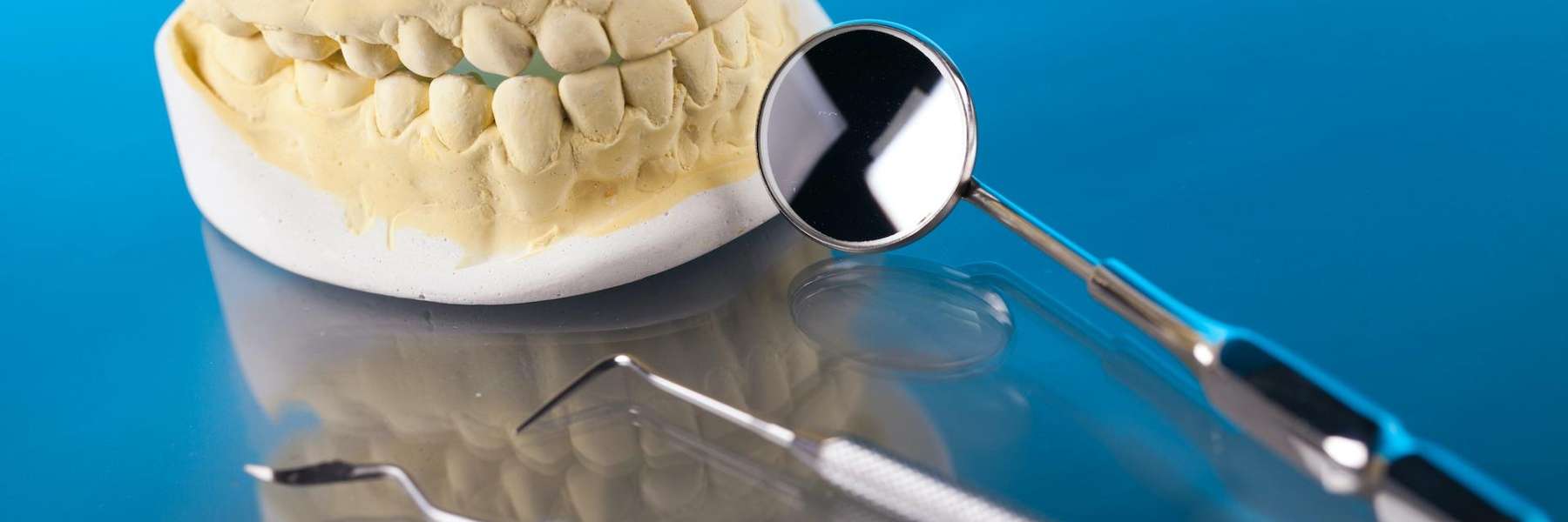 close up of mouth mold with dental tool | family dentist in sunnyvale