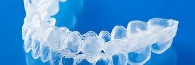 clear plastic aligner | dentist sunnyvale ca