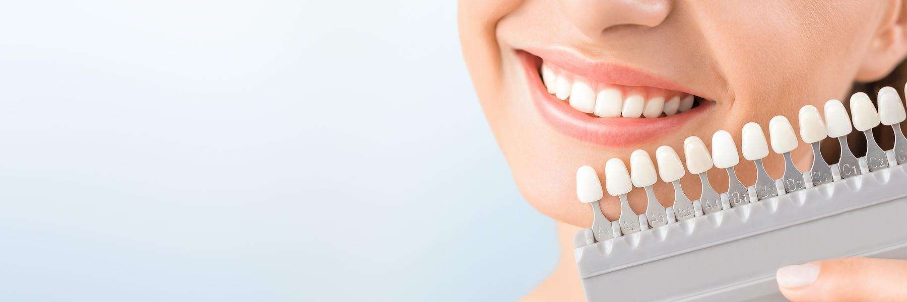 woman picking filling shade | tooth-colored fillings sunnyvale ca